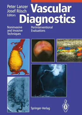 Lanzer / Rösch |  Vascular Diagnostics | Buch |  Sack Fachmedien