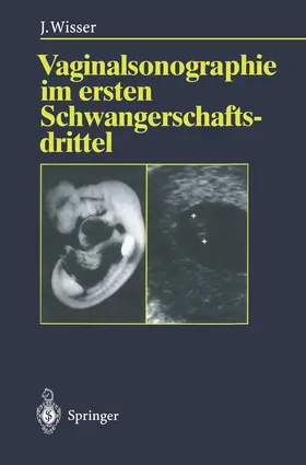 Wisser |  Vaginalsonographie im ersten Schwangerschaftsdrittel | Buch |  Sack Fachmedien