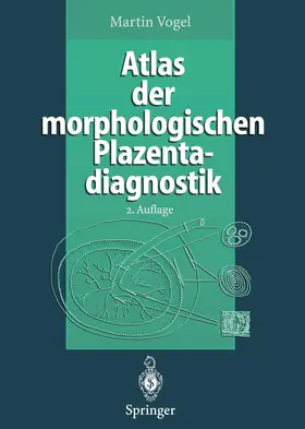 Vogel |  Atlas der morphologischen Plazentadiagnostik | Buch |  Sack Fachmedien