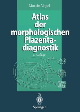 Vogel | Atlas der morphologischen Plazentadiagnostik | Buch | 978-3-642-80084-9 | sack.de