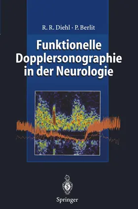 Diehl / Berlit |  Funktionelle Dopplersonographie in der Neurologie | Buch |  Sack Fachmedien