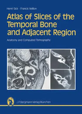 Sick / Veillon |  Atlas of Slices of the Temporal Bone and Adjacent Region | eBook | Sack Fachmedien