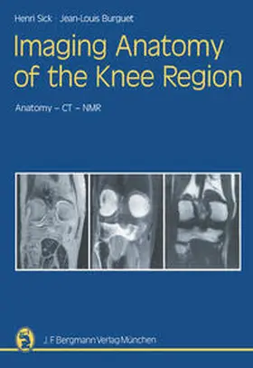 Sick / Burguet |  Imaging Anatomy of the Knee Region | eBook | Sack Fachmedien
