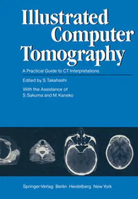 Takahashi / Sakuma / Kaneko |  Illustrated Computer Tomography | eBook | Sack Fachmedien