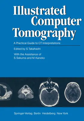 Takahashi / Sakuma / Kaneko |  Illustrated Computer Tomography | Buch |  Sack Fachmedien