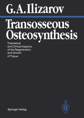 Ilizarov |  Transosseous Osteosynthesis | Buch |  Sack Fachmedien