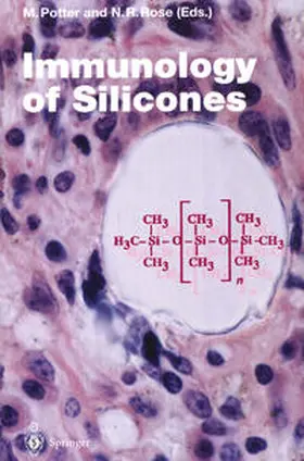 Potter / Rose |  Immunology of Silicones | eBook | Sack Fachmedien
