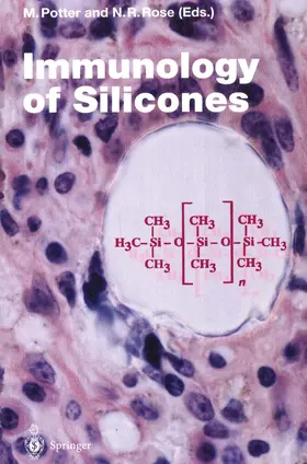 Potter / Rose |  Immunology of Silicones | Buch |  Sack Fachmedien
