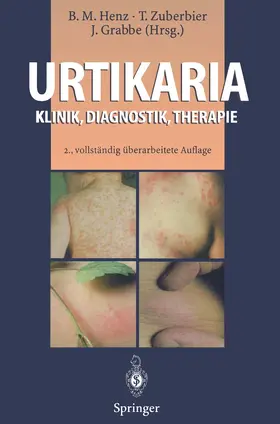 Henz / Zuberbier / Grabbe |  Urtikaria | Buch |  Sack Fachmedien