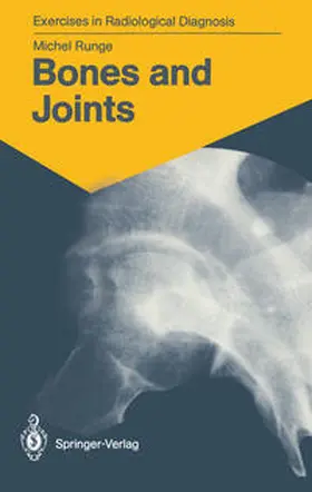 Runge |  Bones and Joints | eBook | Sack Fachmedien