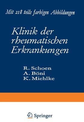 Schoen / Miehlke / Böni | Klinik der rheumatischen Erkrankungen | Buch | 978-3-642-87174-0 | sack.de