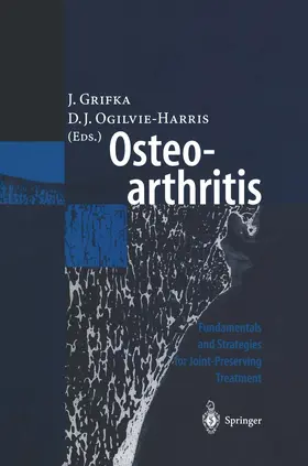 Grifka / Ogilvie-Harris |  Osteoarthritis | Buch |  Sack Fachmedien