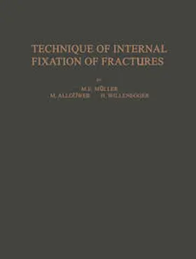 Müller / Bandi / Straumann |  Technique of Internal Fixation of Fractures | eBook | Sack Fachmedien