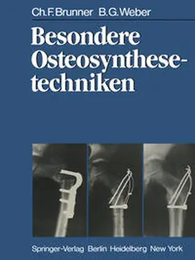 Brunner / Weber |  Besondere Osteosynthesetechniken | eBook | Sack Fachmedien