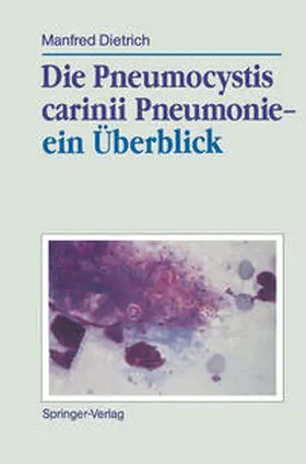 Dietrich |  Die Pneumocystis carinii Pneumonie- ein Überblick | eBook | Sack Fachmedien