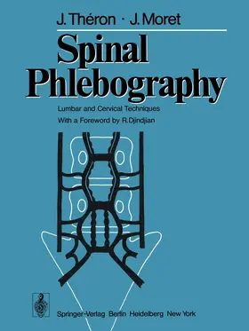 Theron / Moret |  Spinal Phlebography | Buch |  Sack Fachmedien