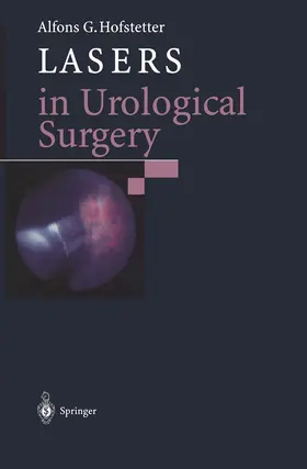 Hofstetter |  Lasers in Urological Surgery | Buch |  Sack Fachmedien
