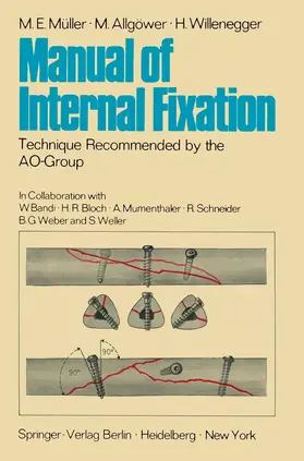 Müller / Allgöwer / Willenegger |  Manual of Internal Fixation | Buch |  Sack Fachmedien