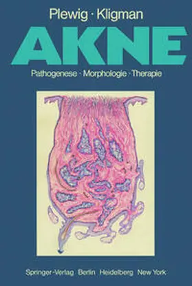 Plewig / Kligman |  Akne | eBook | Sack Fachmedien