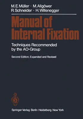 Müller / Allgöwer / Schneider |  Manual of Internal Fixation | eBook | Sack Fachmedien