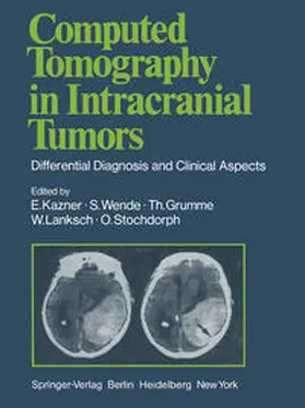 Bradac / Kazner / Kretzschmar |  Computed Tomography in Intracranial Tumors | eBook | Sack Fachmedien
