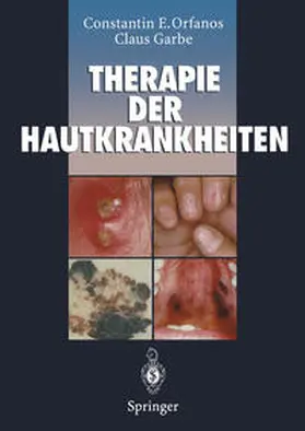 Orfanos / Garbe |  Therapie der Hautkrankheiten | eBook | Sack Fachmedien