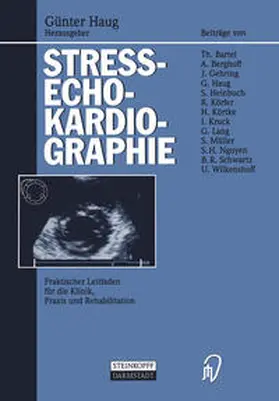 Haug |  Streßechokardiographie | eBook | Sack Fachmedien