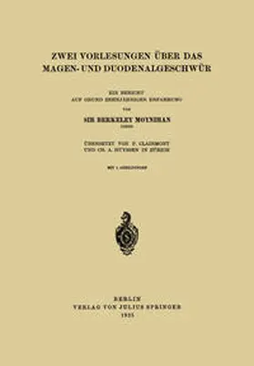 Moynihan / Clairmont |  Zwei Vorlesungen über das Magen- und Duodenalgeschwür | eBook | Sack Fachmedien