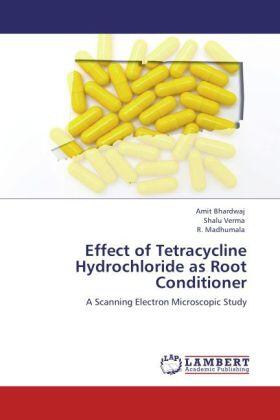 Bhardwaj / Verma / Madhumala |  Effect of Tetracycline Hydrochloride as Root Conditioner | Buch |  Sack Fachmedien