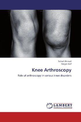 Ahmad / Asif |  Knee Arthroscopy | Buch |  Sack Fachmedien