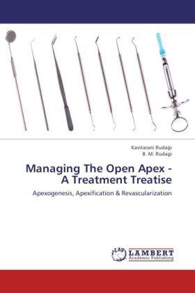 Rudagi | Managing The Open Apex - A Treatment Treatise | Buch | 978-3-659-17890-0 | sack.de