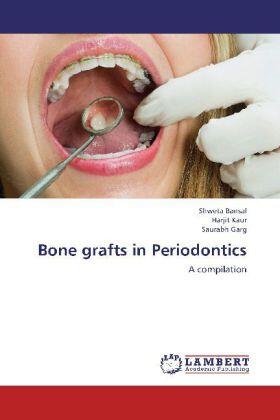 Bansal / Kaur / Garg | Bone grafts in Periodontics | Buch | 978-3-659-20489-0 | sack.de