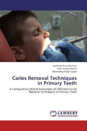 Kochhar / Pandit / Uppal | Caries Removal Techniques in Primary Teeth | Buch | sack.de