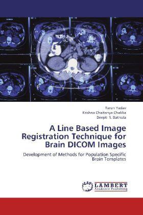 Yadav / Chakka / Bathula |  A Line Based Image Registration Technique for Brain DICOM Images | Buch |  Sack Fachmedien