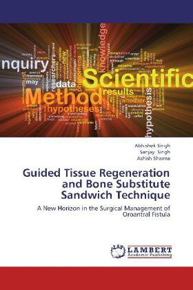 Singh / Sharma | Guided Tissue Regeneration and Bone Substitute Sandwich Technique | Buch | 978-3-659-34670-5 | sack.de