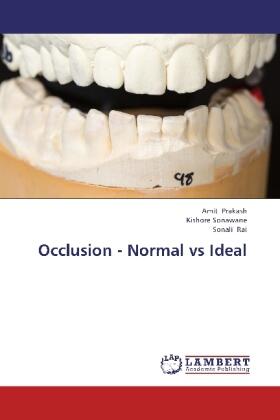 Prakash / Sonawane / Rai | Occlusion - Normal vs Ideal | Buch | 978-3-659-34792-4 | sack.de