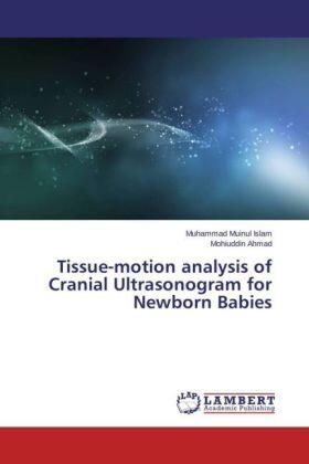 Islam / Ahmad |  Tissue-motion analysis of Cranial Ultrasonogram for Newborn Babies | Buch |  Sack Fachmedien
