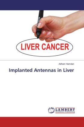 Hamdan | Implanted Antennas in Liver | Buch | 978-3-659-43671-0 | sack.de