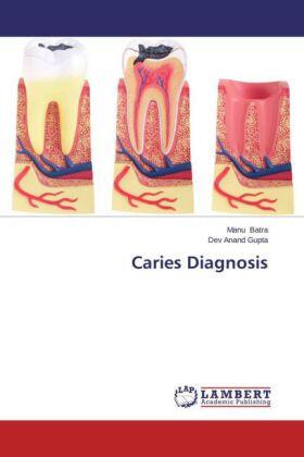 Batra / Gupta |  Caries Diagnosis | Buch |  Sack Fachmedien