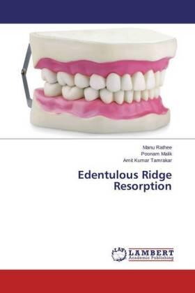 Rathee / Malik / Tamrakar |  Edentulous Ridge Resorption | Buch |  Sack Fachmedien
