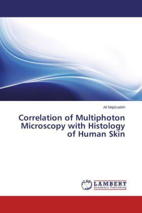 Majdzadeh | Correlation of Multiphoton Microscopy with Histology of Human Skin | Buch | 978-3-659-53035-7 | sack.de