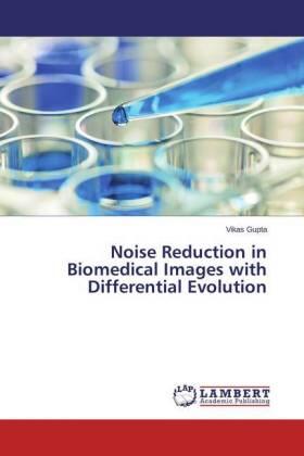 Gupta |  Noise Reduction in Biomedical Images with Differential Evolution | Buch |  Sack Fachmedien