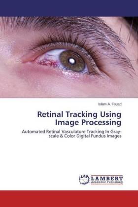 Fouad | Retinal Tracking Using Image Processing | Buch | 978-3-659-56233-4 | sack.de