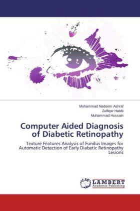 Nadeem Ashraf / Habib / Hussain |  Computer Aided Diagnosis of Diabetic Retinopathy | Buch |  Sack Fachmedien