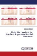 Ramamoorthi / Esfandiari |  Retention system for Implant Supported Partial Dentures | Buch |  Sack Fachmedien