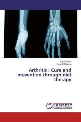 Shukla / Sharma |  Arthritis : Cure and prevention through diet therapy | Buch |  Sack Fachmedien