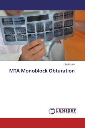 Iqbal | MTA Monoblock Obturation | Buch | 978-3-659-82598-9 | sack.de