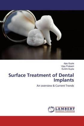 Gupta / Prakash |  Surface Treatment of Dental Implants | Buch |  Sack Fachmedien
