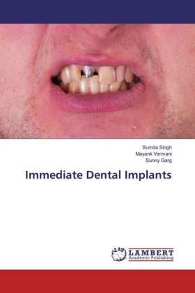 Singh / Vermani / Garg | Immediate Dental Implants | Buch | 978-3-659-87920-3 | sack.de