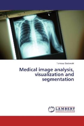 Sadowski |  Medical image analysis, visualization and segmentation | Buch |  Sack Fachmedien